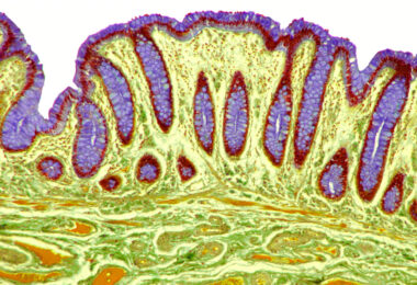 A microscopic image of intestinal villi and the passage of feces.