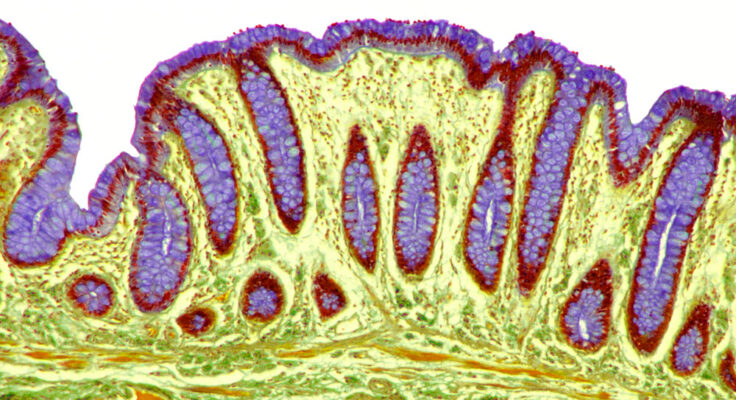 A microscopic image of intestinal villi and the passage of feces.