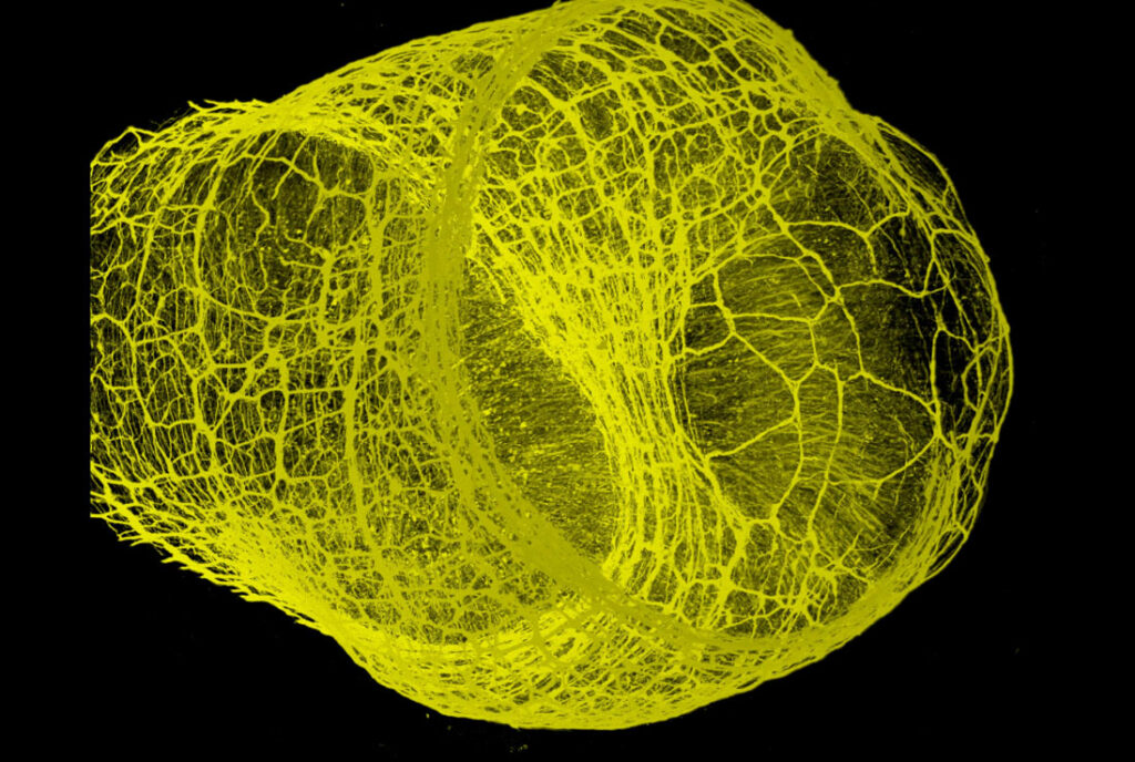 a yellow scientific image against a black background
