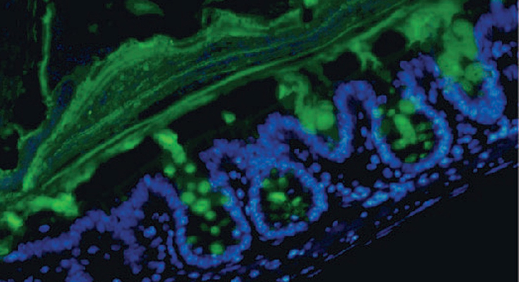 A microscopic image of thick mucus (green) acting as a barrier for the "goblet" cells (blue).